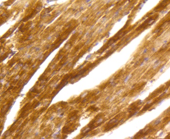 PRKCA Antibody [45F9]
