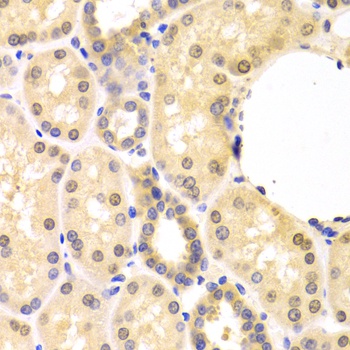 SMAD1 Antibody