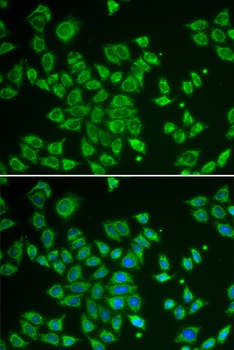 SMAD1 Antibody
