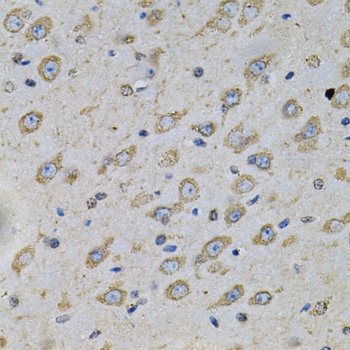 ATP2A2 Antibody