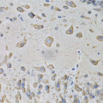 ATP2A2 Antibody