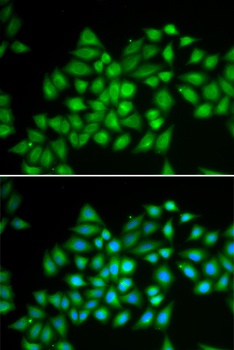 ATP2A2 Antibody