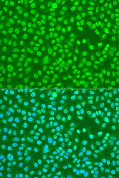 HNRNPDL Antibody
