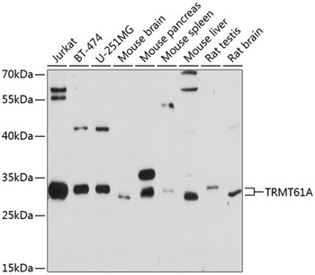 TRMT61A Antibody