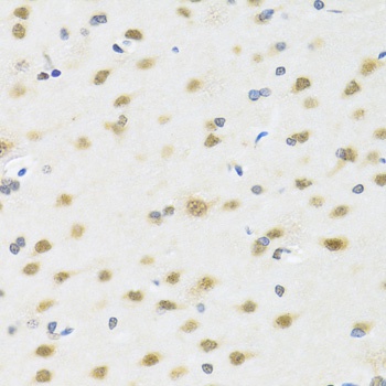 MTAP Antibody