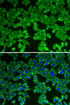 MTAP Antibody