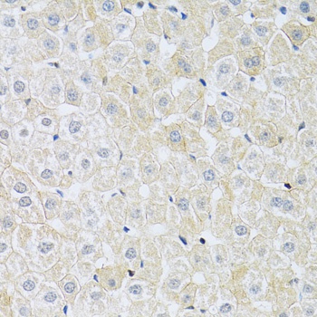 SLC4A5 Antibody