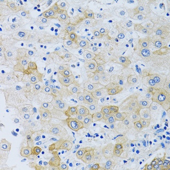 SLC4A5 Antibody