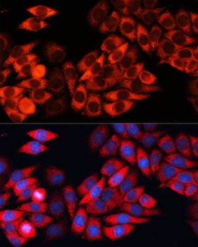 EIF3B Antibody