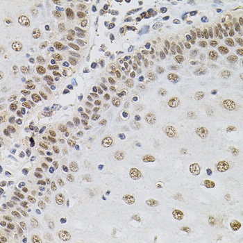 TGM2 Antibody