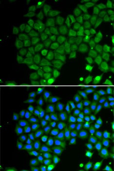 GAD2 Antibody