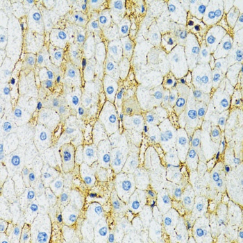 SLC1A2 Antibody