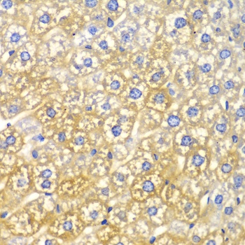 FASN Antibody