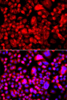 FASN Antibody