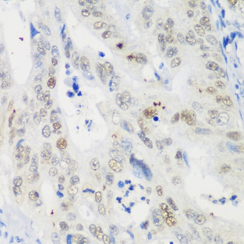 TP53 Antibody