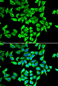 TP53 Antibody