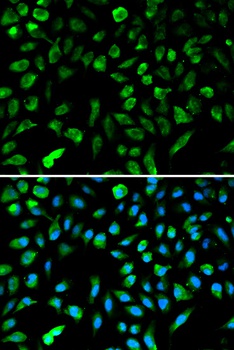 NME1 Antibody