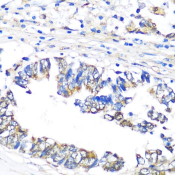 NAMPT Antibody