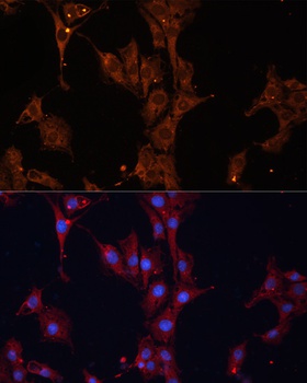 HSPB1 Antibody