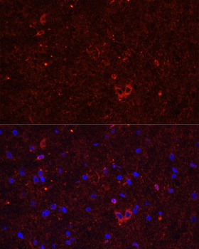 GRIA2 Antibody