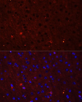 GRIA2 Antibody