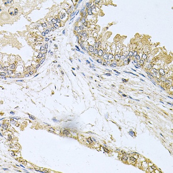 BCR Antibody