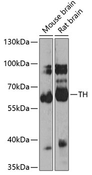 TH Antibody