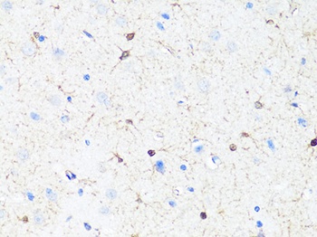 TH Antibody