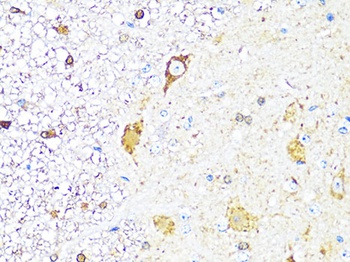 TH Antibody