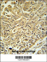 GSTK1 Antibody