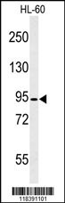 CAPN3 Antibody