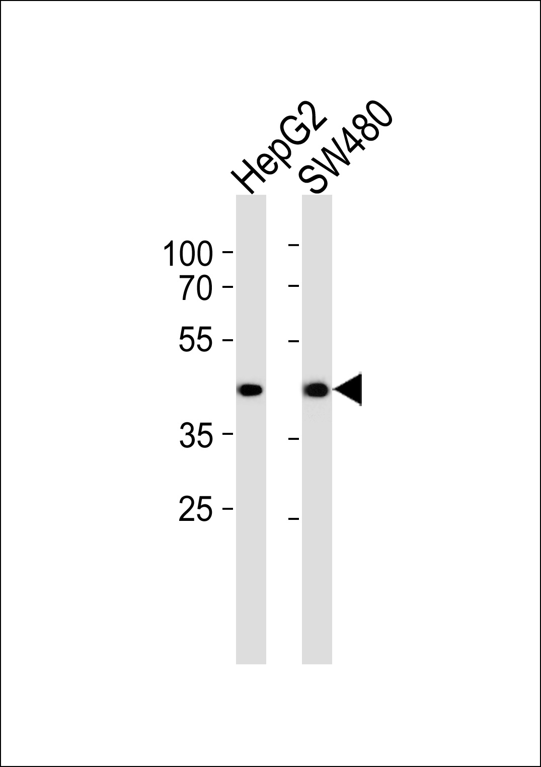 ADH7 Antibody