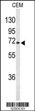 GABRA4 Antibody