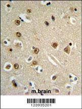 GABRA4 Antibody