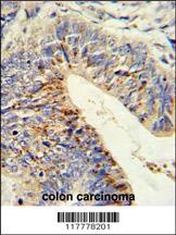 ADAMDEC1 Antibody