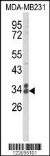 CLTA Antibody