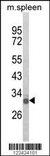 OLIG3 Antibody