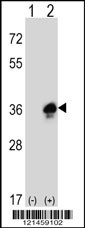 MPZ Antibody