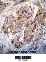 DUSP3 Antibody