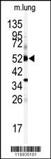 CYP1A1 Antibody