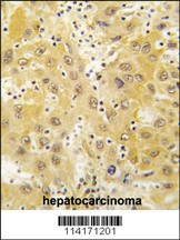 Tiparp Antibody