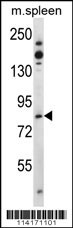 Tiparp Antibody