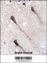PUM1 Antibody