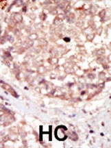 HIPK3 Antibody