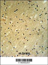 BCOR Antibody