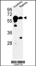 CBS Antibody