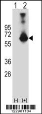 CBS Antibody