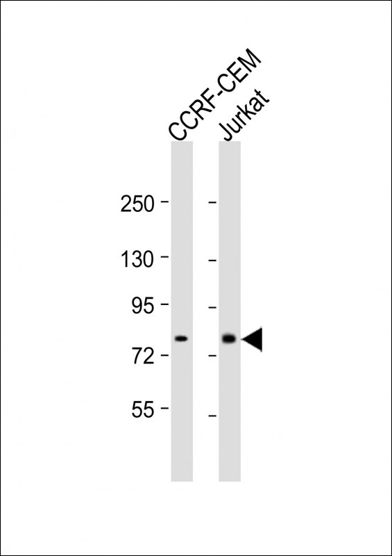 MT-ND5 Antibody
