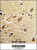 MT-ND5 Antibody