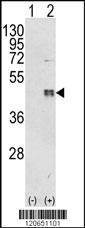 CEBPB Antibody